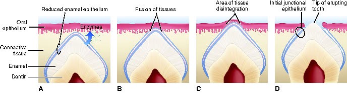 Sequential diagrams illustrating the process of tooth eruption: A) Enzymatic breakdown of reduced enamel epithelium, B) Fusion of tissues, C) Tissue disintegration creating a path for the tooth, D) Tooth emerging through the oral epithelium.