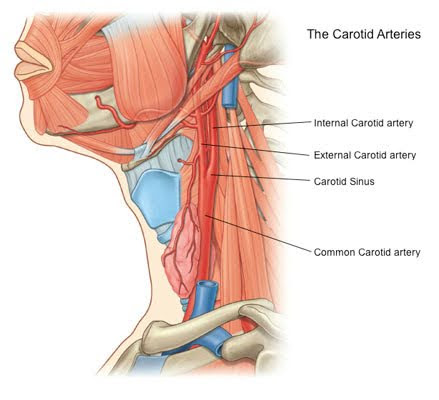 Anatomical illustration showing the Carotid arteries in the human neck, labeled to differentiate the Common Carotid artery, Internal Carotid artery, External Carotid artery, and Carotid Sinus.