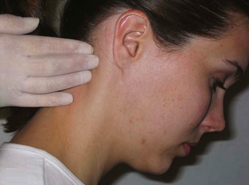 a young woman having her occipital lymph nodes examined