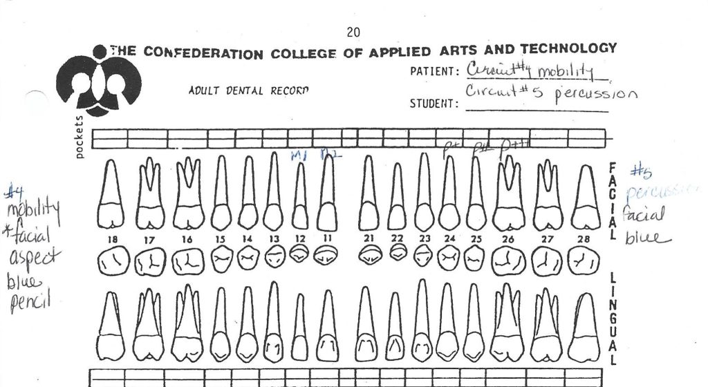 Annotated adult dental record chart from a dental college, highlighting specific dental issues such as mobility and percussion, with detailed notes and symbols near the affected tooth areas.