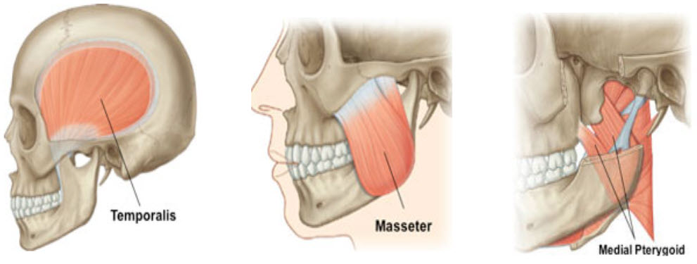 Three-part anatomical illustration showing the muscles of mastication in the human skull: Temporalis muscle highlighted in the side view, Masseter muscle in the three-quarter view, and Medial Pterygoid muscle in the interior view.