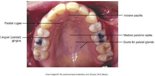 Close-up medical image of the human hard palate, showing teeth, the incisive papilla, median palatine raphe, ducts for palatal glands, palatal rugae, and lingual (palatal) gingiva, labeled for educational purposes.