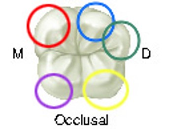 Close-up illustration of the occlusal surface of a mandibular first molar with colored rings highlighting different cusp areas: red, blue, green, purple, and yellow.