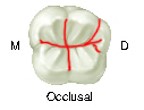 Illustration of the occlusal surface of a mandibular first molar with red lines depicting the fissure pattern, labeled with 'M' for mesial and 'D' for distal.