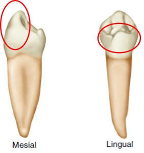 Side-by-side images of a mandibular first premolar from mesial and lingual views. Each image features a red circle highlighting the unique cusp shape visible from these perspectives.