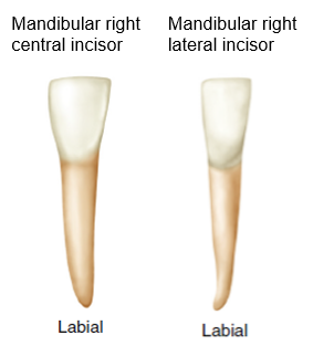 Illustration showing labial views of a mandibular right central incisor and a mandibular right lateral incisor, depicting slight variations in shape and size between the two teeth.