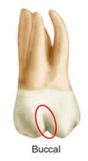 Buccal view of a maxillary second molar showing two prominent roots, with a red circle highlighting a deep concavity on the root closest to the viewer.