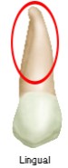 Lingual view of a maxillary second premolar, with a red circle highlighting the elongated and pointed cusp tip characteristic of this tooth.