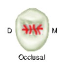 Occlusal view of a maxillary second premolar, marked with 'M' for mesial and 'D' for distal, featuring a central red mark indicating the pulp chamber configuration within the tooth.