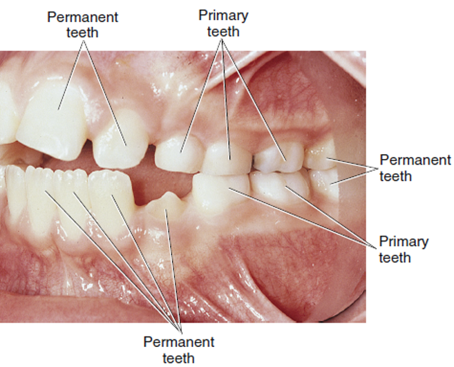 Close-up photograph of a child's open mouth showing mixed dentition, with arrows pointing to both primary and permanent teeth visible in the lower and upper jaws.