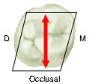 Occlusal view of a maxillary molar with a diagrammatic hexagonal outline and a double-headed red arrow indicating the tooth's mesiodistal dimension, labeled 'M' for mesial and 'D' for distal.