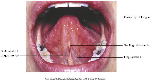 Close-up medical image of the underside of a human tongue showing the fimbriated fold, lingual frenum, sublingual caruncle, lingual veins, and the raised tip of the tongue, all labeled for educational purposes.