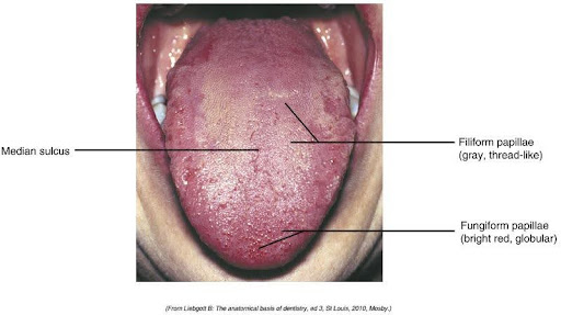 Medical image of a human tongue displaying the median sulcus, filiform papillae (gray, thread-like), and fungiform papillae (bright red, globular), each labeled for educational purposes.