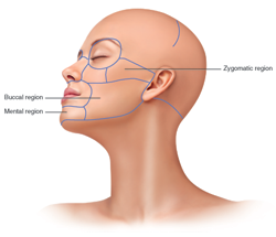 An illustration of a woman's head profile with labeled anatomical regions, including the zygomatic, buccal, and mental areas.