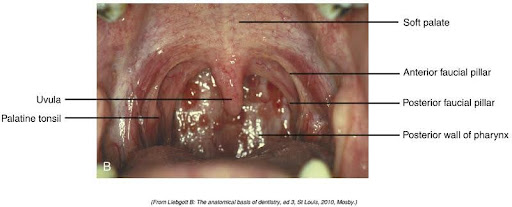 Close-up medical image of the human soft palate, showing the uvula, palatine tonsil, anterior and posterior faucial pillars, and the posterior wall of the pharynx, all labeled for educational purposes.