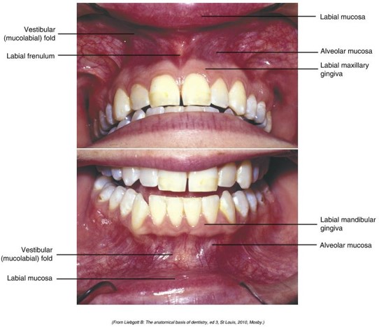 Close-up image of an open mouth showing a detailed view of the oral cavity with labeled features including the vestibular fold, labial frenulum, labial mucosa, alveolar mucosa, and labial gingiva for both maxillary and mandibular regions.