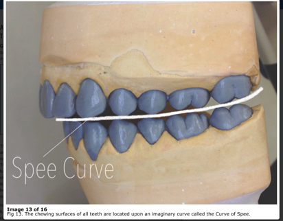 Model of a human dental arch displaying the Curve of Spee, with a line running across the occlusal surfaces of the teeth to illustrate the natural curvature in a side view of the dental cast.