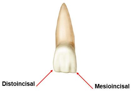 Illustration of a tooth showing the incisal view with labels pointing to the distoincisal and mesioincisal corners.