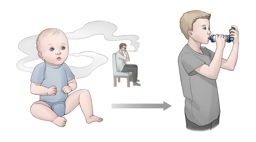 A baby inhales second-hand smoke from a member of the household. When the grows older as a child, they are using an inhaler with a spacer to treat asthma symptoms.