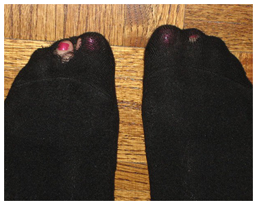 Old, black socks with holes in the toes.
