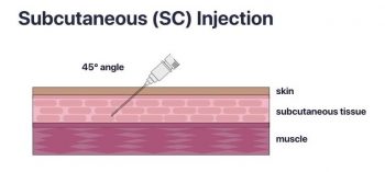 Syringe and Needle Selection – Vaccine Practice for Health ...