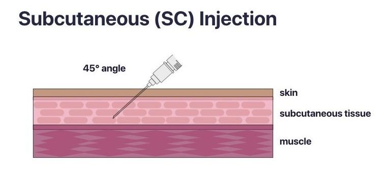 A 5/8 safety-engineered needle at a 45 degree angle to the skin, in the subcutaneous tissue. Epidermis layers labelled include skin, subcutaneous tissue and muscle respectively.