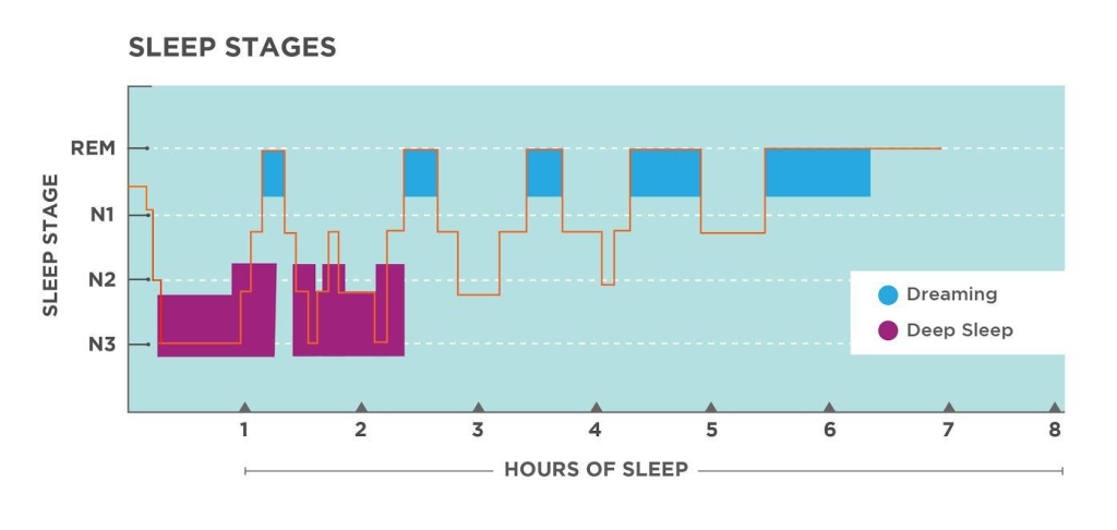 Graph of sleep stages showing the cycles of dreaming and deep sleep.