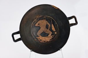 Red-figure painting of a toilet scene featuring a nude woman self-depilating with an oil lamp. She hold the lamp in one hand while squatting over the flame; in her other hand she holds a damp cloth in case of burns.