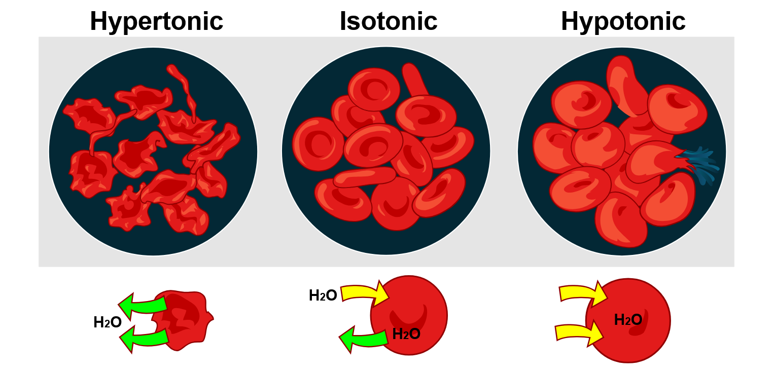 Hypertonic, Isotonic and Hypotonic solutions.