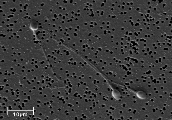 Human Sperm under a microscope