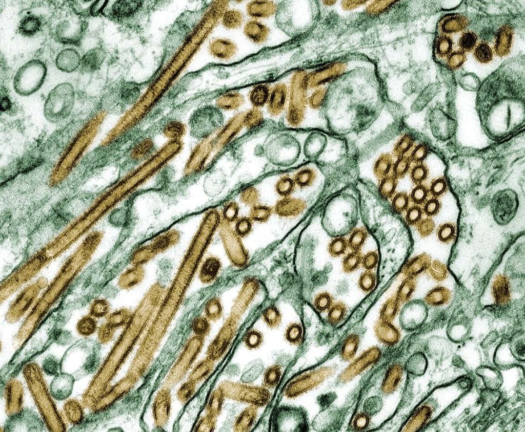 The inside of a cell being invaded by a virus.