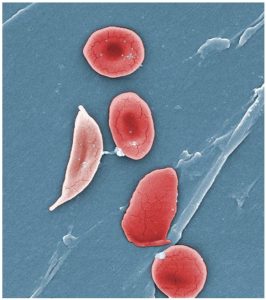 Variations of red blood cells