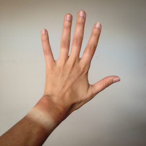 Tan lines showing on an arm