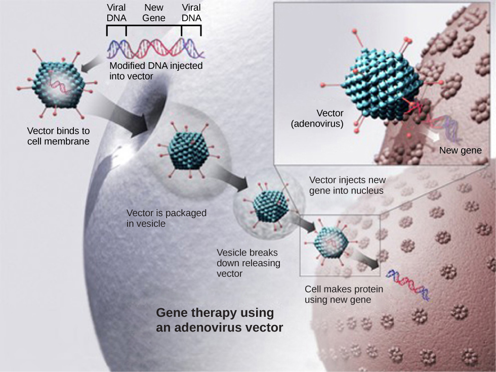 steps in gene therapy. see image description