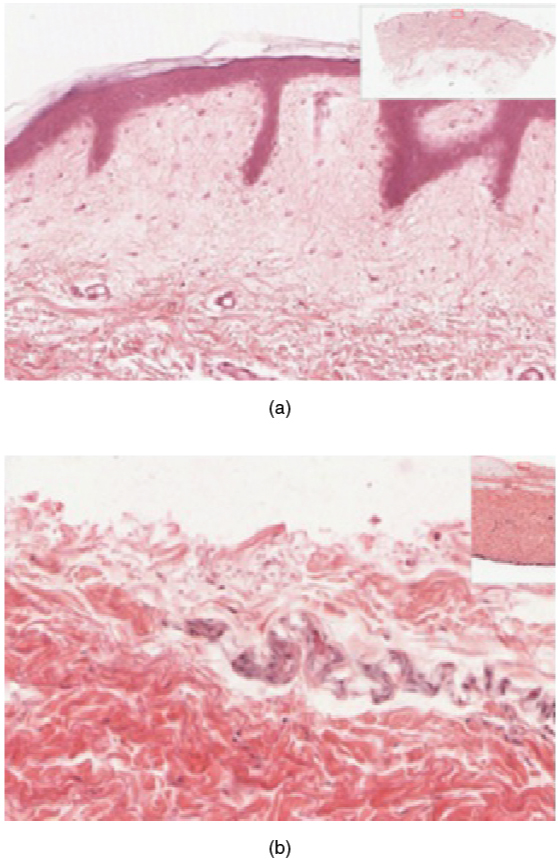 Part A is a micrograph showing a cross section of thin skin. The topmost layer is a thin, translucent layer with irregular texture and areas where cells are sloughing off. The deepest layer is dark purple and extends into the third layer with finger like projections. The third light purple layer contains thin bands of fibers and small, dark cells. The fourth, and deepest layer, is darker than the third layer, but is still light purple. It contains thick fiber bands that are loosely packed. Part B is a magnified view of the epidermis of thick skin. It shows the topmost layer is five times thicker than the topmost layer of thin skin. The topmost layer of thick skin is also denser and less translucent than the topmost layer of thin skin.