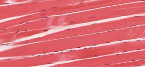 Microscopic image of skeletal muscle tissue showing long, cylindrical fibres with visible striations.