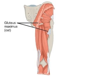 Location of Gluteus maximus (cut)