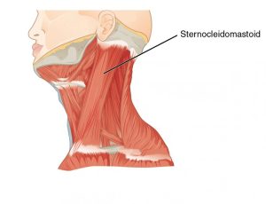 The Sternocleidomastoid