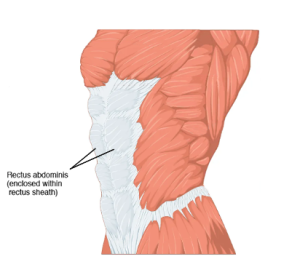 Location of the rectus abdominis (enclosed within rectus sheath)