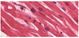 Microscopic image of smooth muscle tissue showing elongated cells with centrally located nuclei and no visible striations.