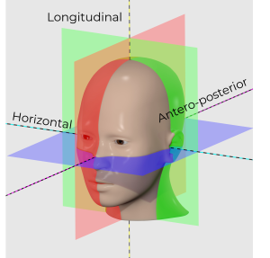A human head divided into 3 axis - horizontal, anteroposterior and longitudinal.