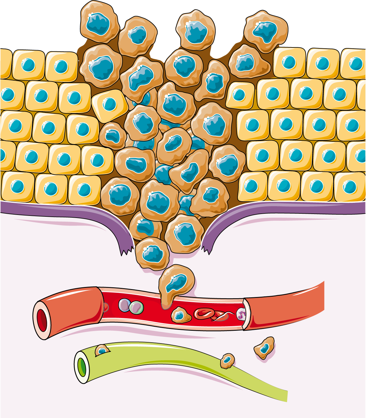 1-1-apoptosis-cancer-selected-topics-in-health-and-disease-2019