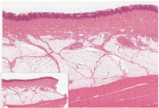 The epidermis. Image description available.