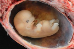 A tiny embryo depicting some development of arms and legs, as well as facial features that are starting to show