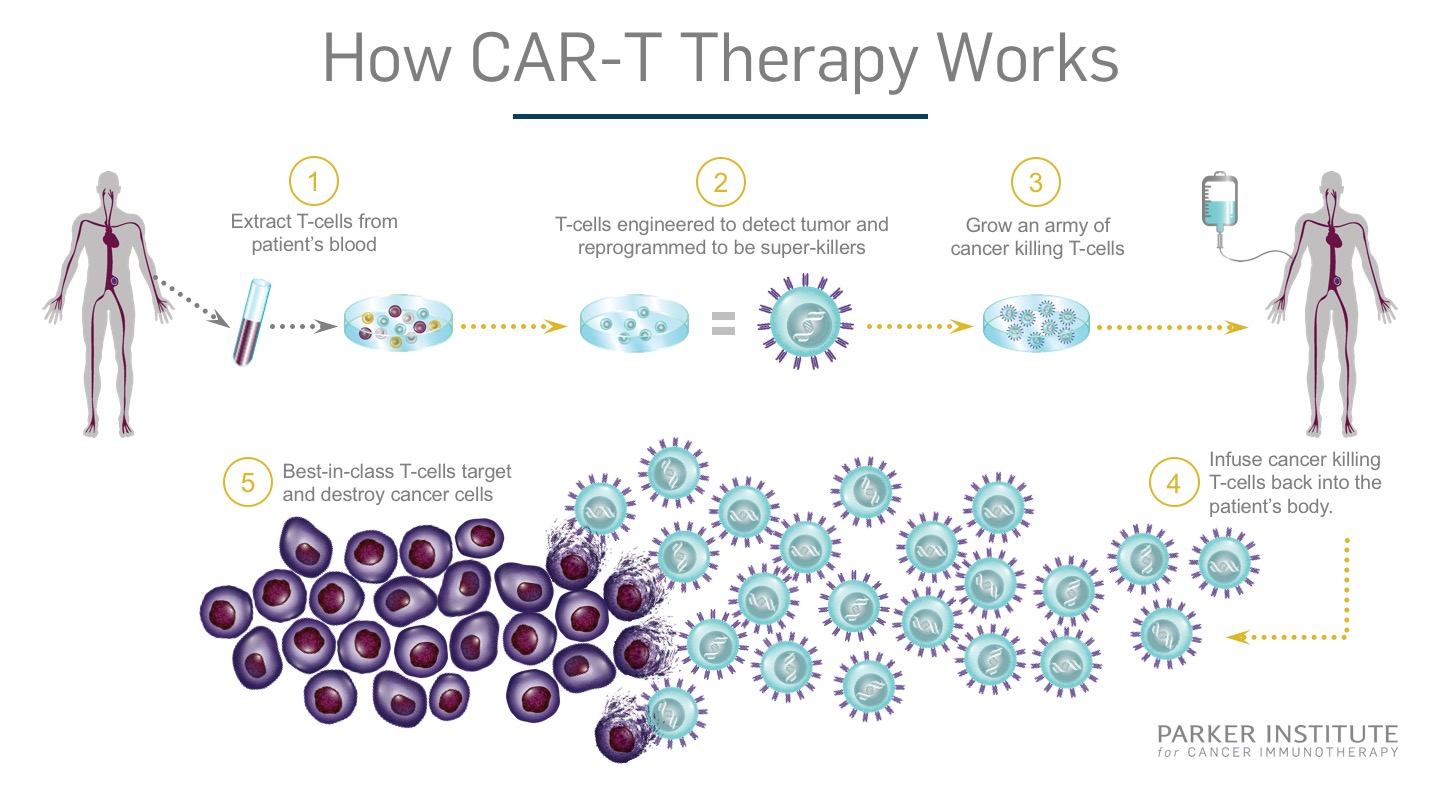 Т терапия. Cd19 car-t терапия. Car t Cell Therapy. Метод car-t клеточной терапии. Car клетки.