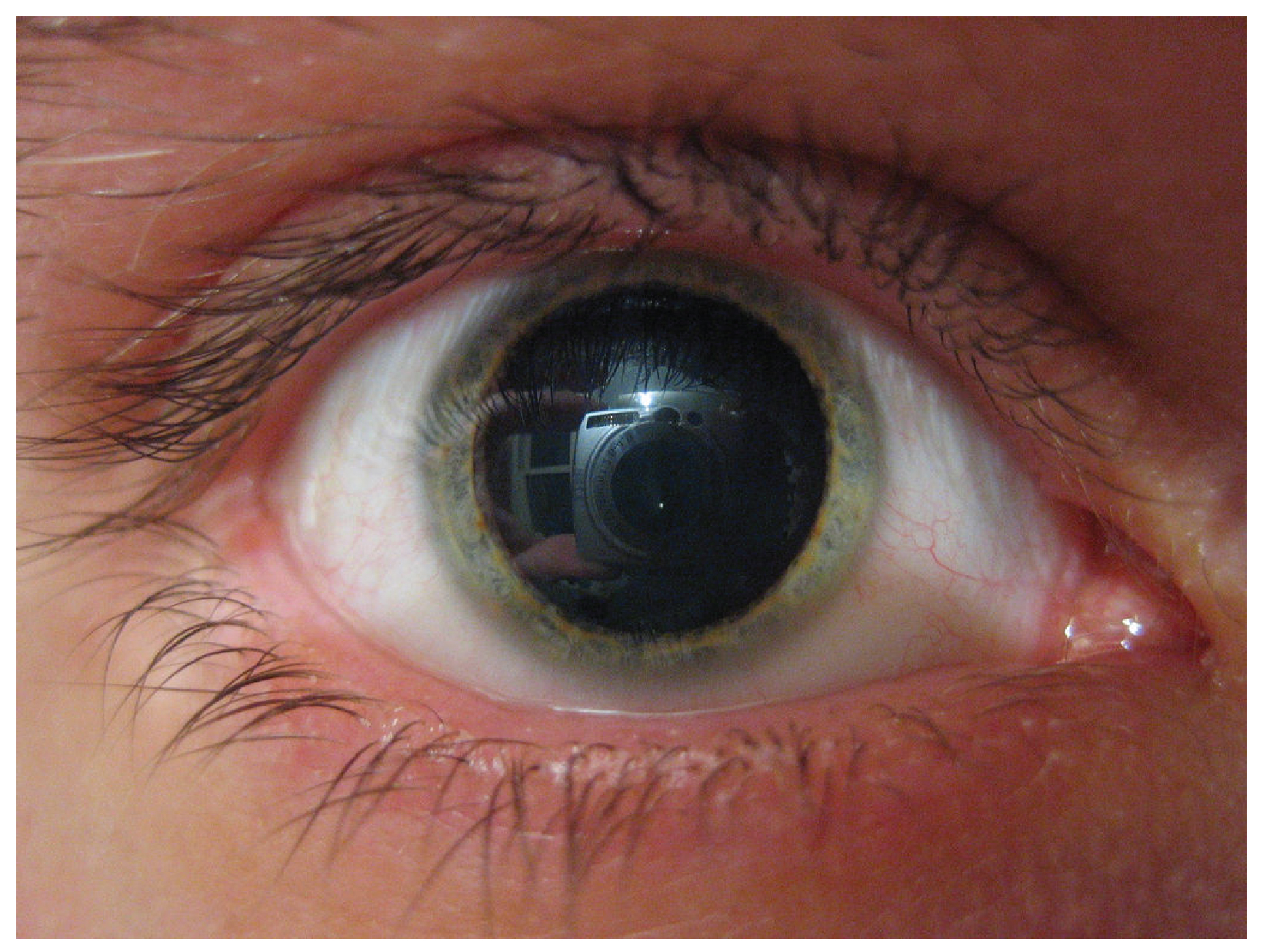 This photograph shows a person’s eye with a relatively large pupil.