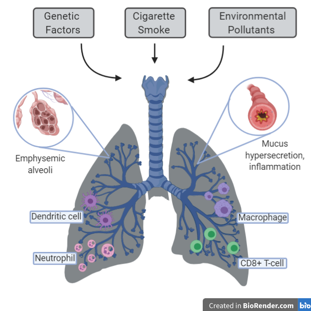 1.1 Overview of COPD and Asthma – Selected Topics in Health and Disease ...