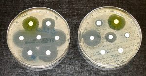 Two petri dishes